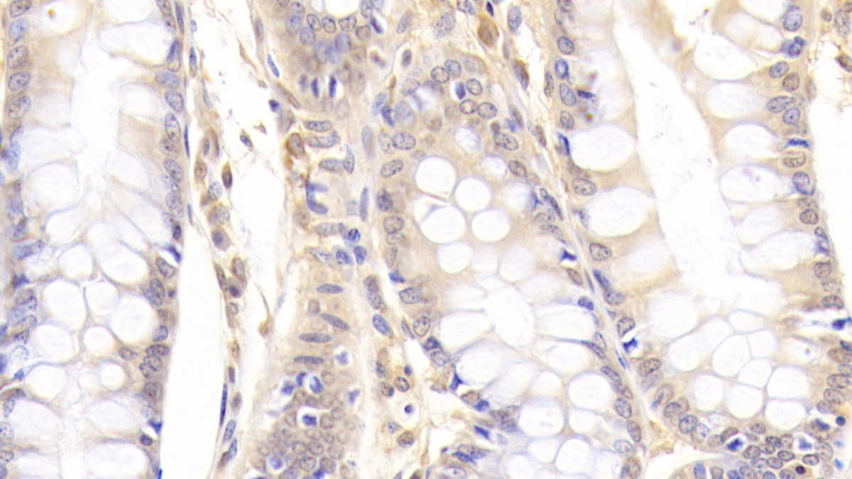 Polyclonal Antibody to Peptidyl Arginine Deiminase Type II (PADI2)