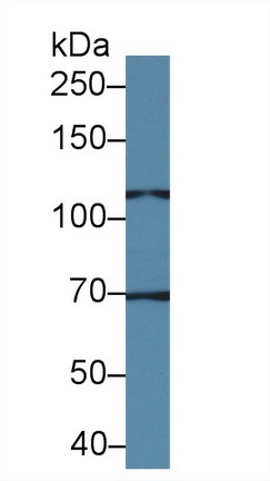 Polyclonal Antibody to Transient Receptor Potential Cation Channel Subfamily C, Member 6 (TRPC6)
