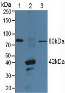 Polyclonal Antibody to Purinergic Receptor P2X, Ligand Gated Ion Channel 7 (P2RX7)