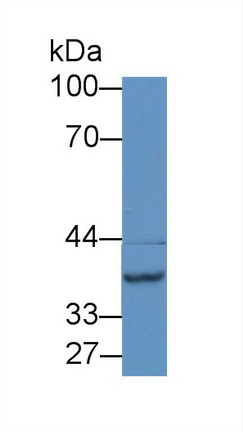 Polyclonal Antibody to N-Acetyltransferase 2 (NAT2)