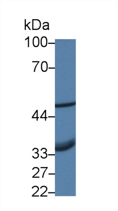 Polyclonal Antibody to Absent In Melanoma 2 (AIM2)