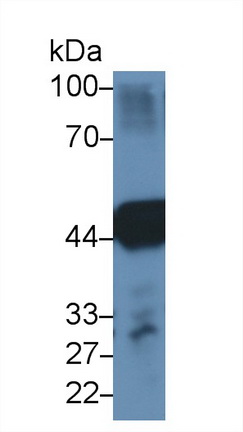Polyclonal Antibody to Betaine Homocysteine Methyltransferase (BHMT)