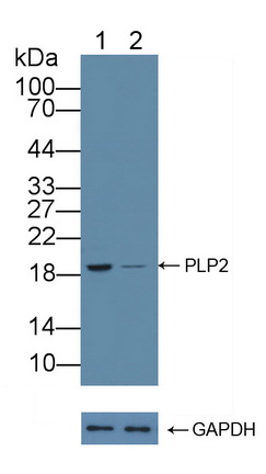 Polyclonal Antibody to Proteolipid Protein 2, Colonic Epithelium Enriched (PLP2)