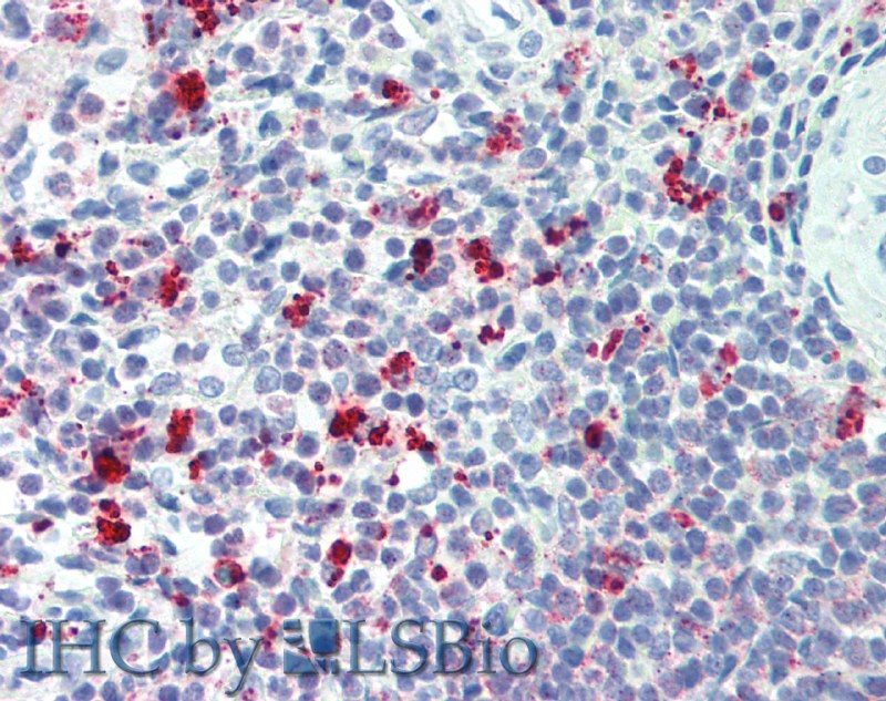 Polyclonal Antibody to Triggering Receptor Expressed On Myeloid Cells 2 (TREM2)