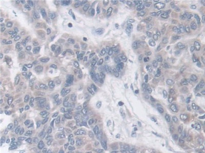Polyclonal Antibody to Breast Cancer Anti-Estrogen Resistance 1 (BCAR1)