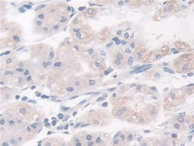 Polyclonal Antibody to Breast Cancer Anti-Estrogen Resistance 1 (BCAR1)