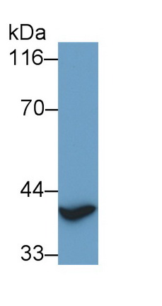 Polyclonal Antibody to Thyroid Transcription Factor 1 (TITF1)