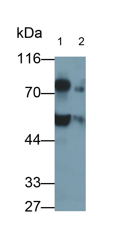 Polyclonal Antibody to Transcobalamin I (TCN1)