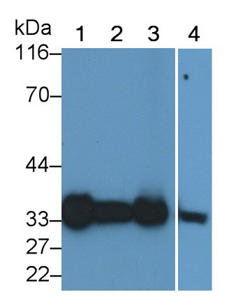 Polyclonal Antibody to Glycine-N-Methyltransferase (GNMT)