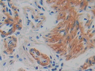 Polyclonal Antibody to Interferon Alpha 7 (IFNa7)