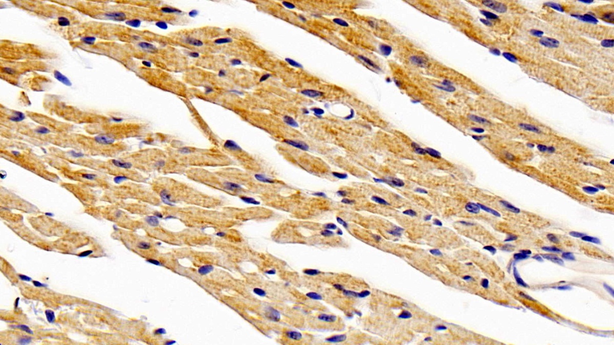 Polyclonal Antibody to Renal Tumor Antigen (RAGE)