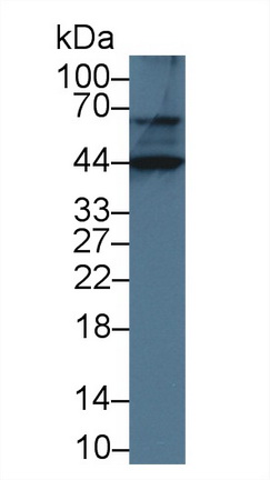 Polyclonal Antibody to Renal Tumor Antigen (RAGE)