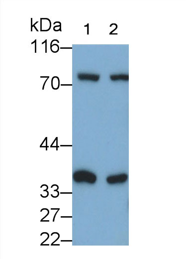 Polyclonal Antibody to Phosphoglycolate Phosphatase (PGP)
