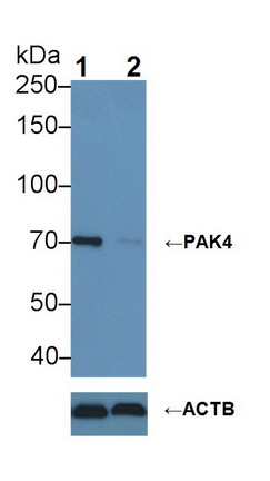 Polyclonal Antibody to p21 Protein Activated Kinase 4 (PAK4)