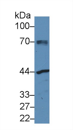 Polyclonal Antibody to N-Acetylgalactosaminidase Alpha (NAGa)