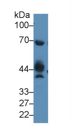 Polyclonal Antibody to N-Acetylgalactosaminidase Alpha (NAGa)