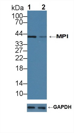 Polyclonal Antibody to Mannose Phosphate Isomerase (MPI)