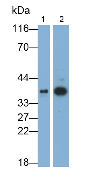 Polyclonal Antibody to Interleukin 1 Receptor Like Protein 1 (IL1RL1)