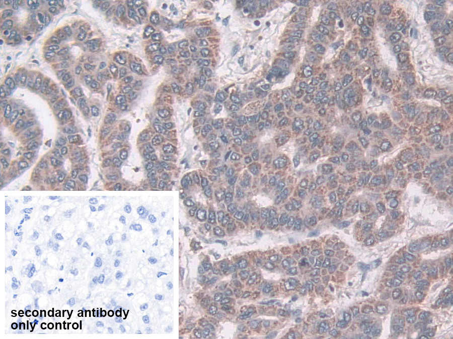 Polyclonal Antibody to Coxsackie Virus And Adenovirus Receptor (CXADR)