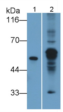 Polyclonal Antibody to Chitinase 1 (CHIT1)