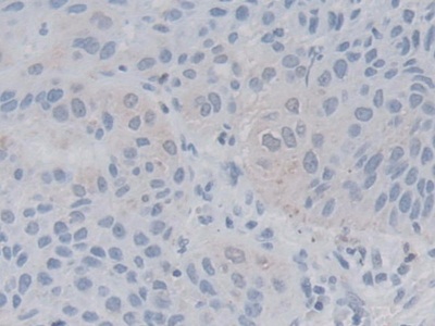 Polyclonal Antibody to Lactamase Beta (LACTb)
