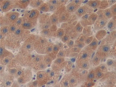 Polyclonal Antibody to Lecithin Cholesterol Acyltransferase (LCAT)