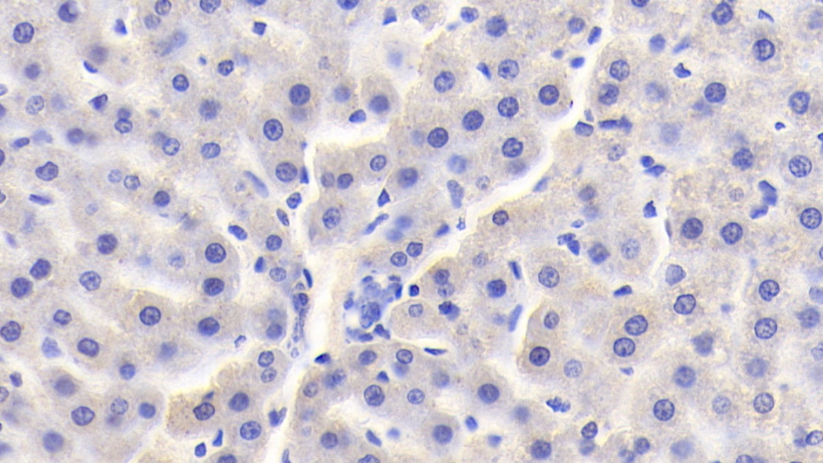 Polyclonal Antibody to Von Hippel Lindau Tumor Suppressor (vHL)