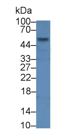 Polyclonal Antibody to V-Set Domain Containing T-Cell Activation Inhibitor 1 (VTCN1)