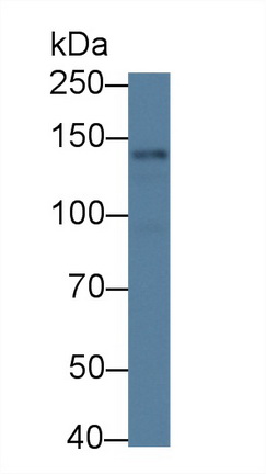 Polyclonal Antibody to NLR Family, Pyrin Domain Containing Protein 3 (NLRP3)