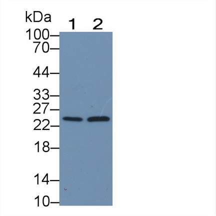 Polyclonal Antibody to RAB5A, Member RAS Oncogene Family (RAB5A)