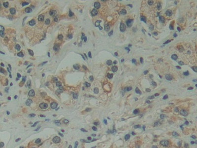 Polyclonal Antibody to Family With Sequence Similarity 3, Member D (FAM3D)