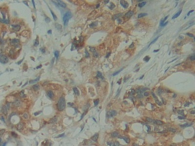 Polyclonal Antibody to Family With Sequence Similarity 3, Member D (FAM3D)