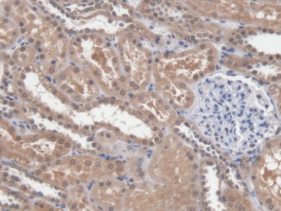 Polyclonal Antibody to Dicer 1, Ribonuclease Type III (DICER1)