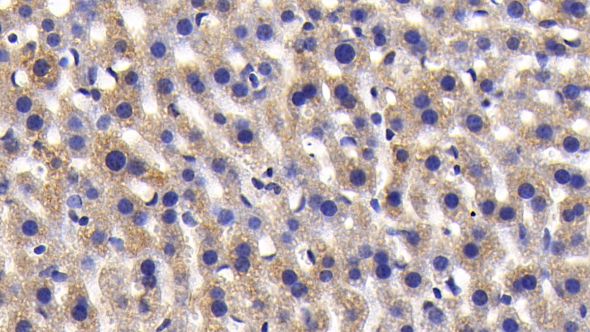 Polyclonal Antibody to Autophagy Related Protein 7 (ATG7)
