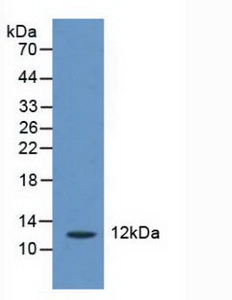 Polyclonal Antibody to CASP2 And RIPK1 Domain Containing Adaptor With Death Domain Protein (CRADD)
