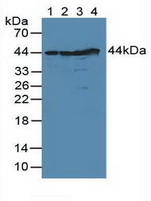 Polyclonal Antibody to DNA Fragmentation Factor Subunit Alpha (DFFa)