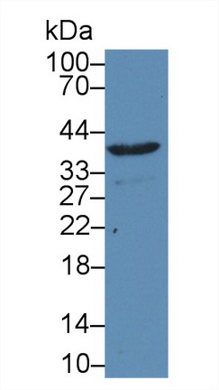 Polyclonal Antibody to DNA Fragmentation Factor Subunit Alpha (DFFa)