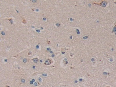 Polyclonal Antibody to Family With Sequence Similarity 3, Member C (FAM3C)