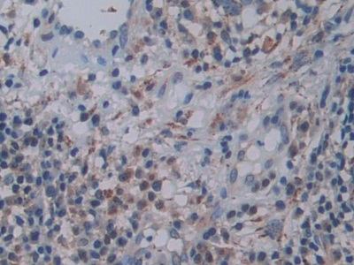 Polyclonal Antibody to Family With Sequence Similarity 3, Member C (FAM3C)