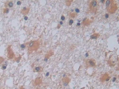 Polyclonal Antibody to Jagged 2 Protein (JAG2)