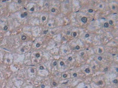 Polyclonal Antibody to Jagged 2 Protein (JAG2)