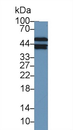 Polyclonal Antibody to Aminoacyl tRNA Synthetase Complex Interacting Multifunctional Protein 1 (AIMP1)