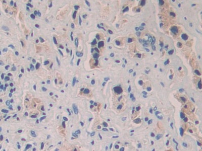 Polyclonal Antibody to Semaphorin 3A (SEMA3A)