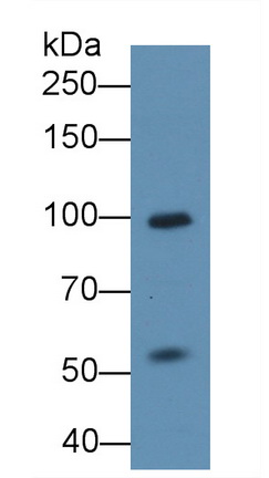 Polyclonal Antibody to Nuclear Factor Of Activated T-Cells, Cytoplasmic 2 (NFATC2)