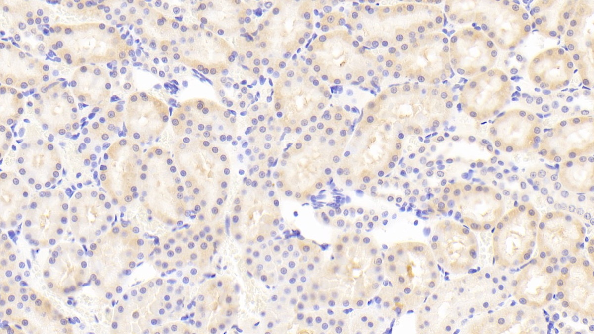 Polyclonal Antibody to Nuclear Factor, Erythroid Derived 2 Like Protein 2 (NFE2L2)