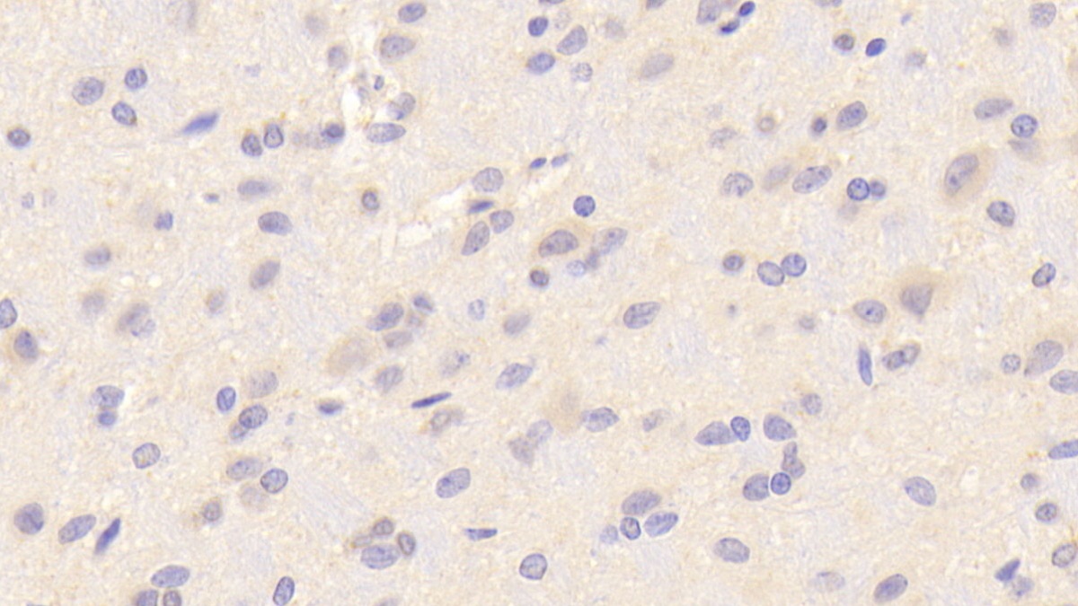 Polyclonal Antibody to Nuclear Factor, Erythroid Derived 2 Like Protein 2 (NFE2L2)