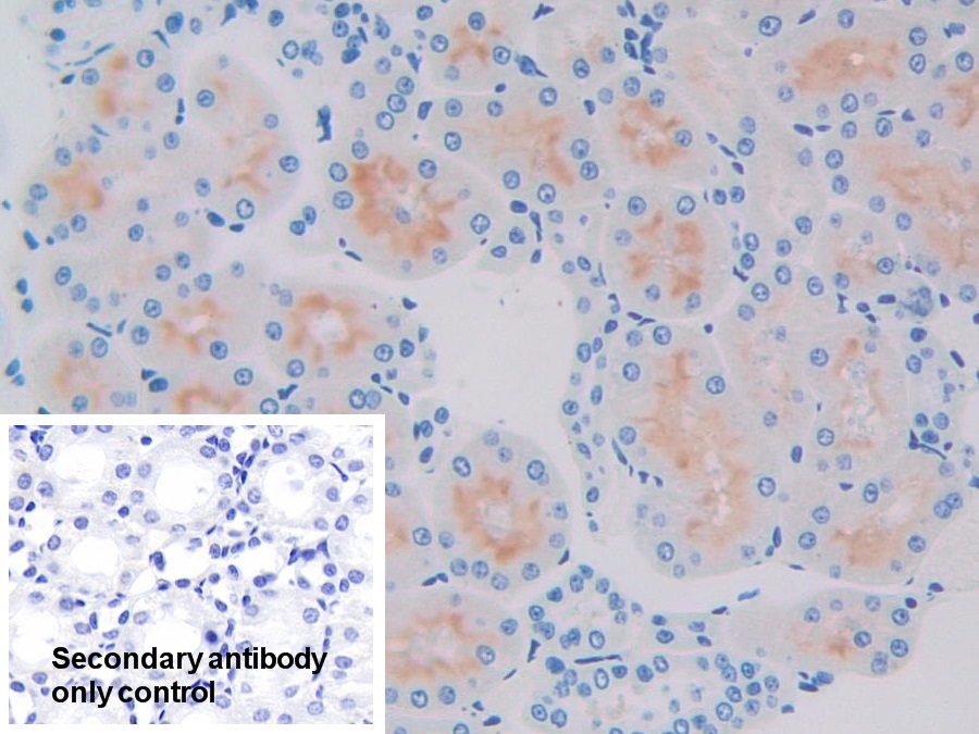 Polyclonal Antibody to Prolactin Induced Protein (PIP)