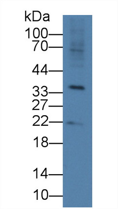 Polyclonal Antibody to R-Spondin 3 (RSPO3)