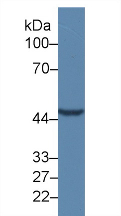 Polyclonal Antibody to Tomoregulin 1 (TR1)