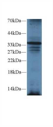 Polyclonal Antibody to TNFRSF1A Associated Via Death Domain Protein (TRADD)